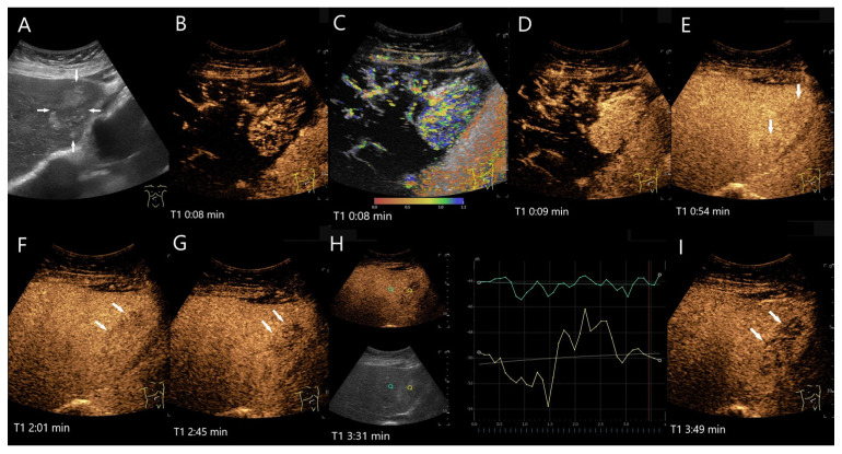 Figure 18