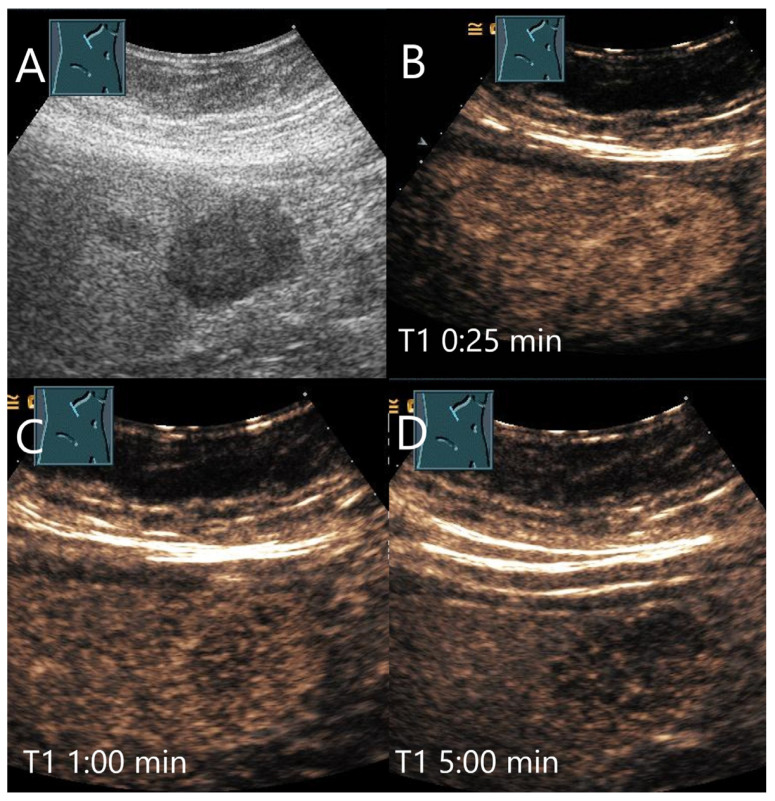 Figure 19