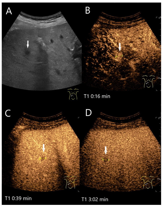 Figure 20