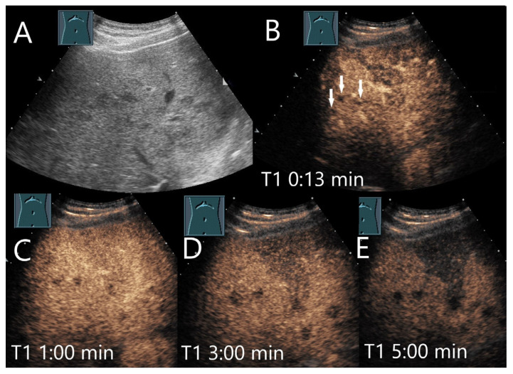 Figure 22