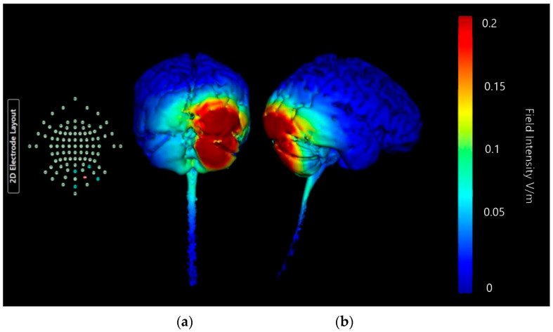 Figure 15