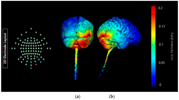 Figure 17