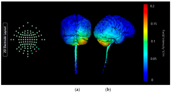 Figure 18