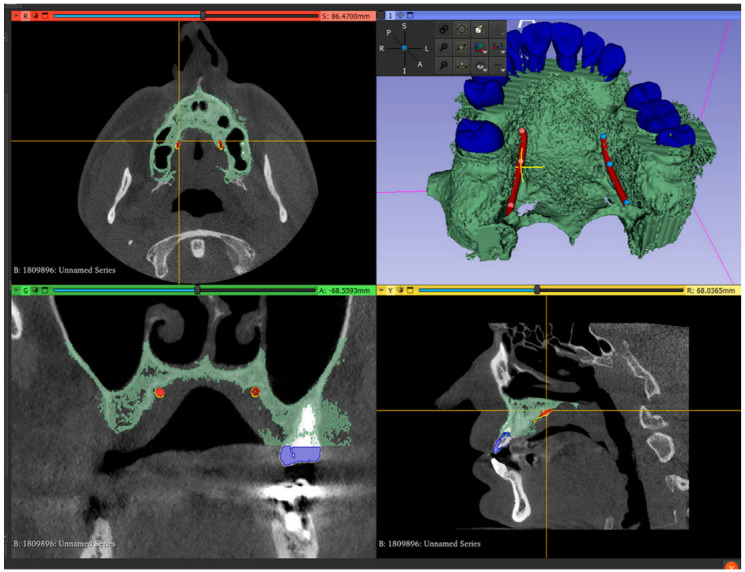 Figure 2