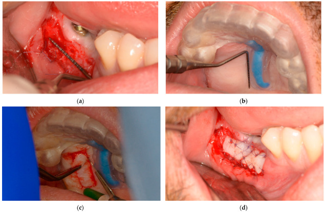Figure 7