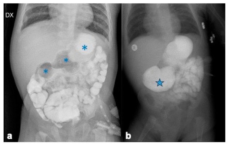 Figure 9