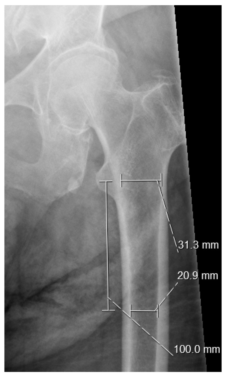 Figure 1
