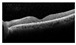 Figure 23