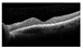 Figure 25