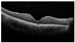 Figure 26