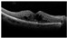 Figure 28