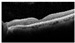 Figure 29