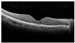 Figure 30