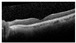 Figure 31