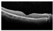 Figure 33