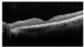 Figure 34