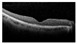 Figure 35