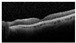 Figure 36