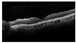 Figure 38