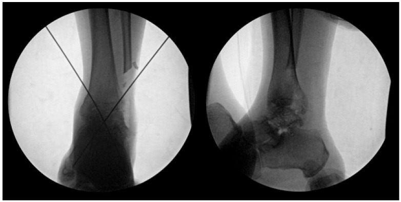 Figure 5
