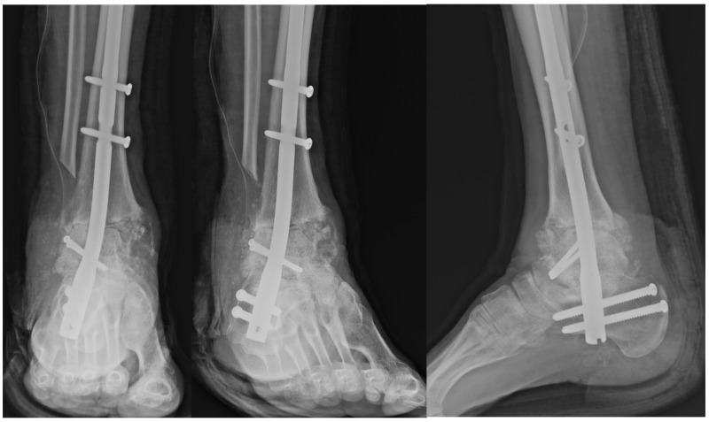 Figure 6