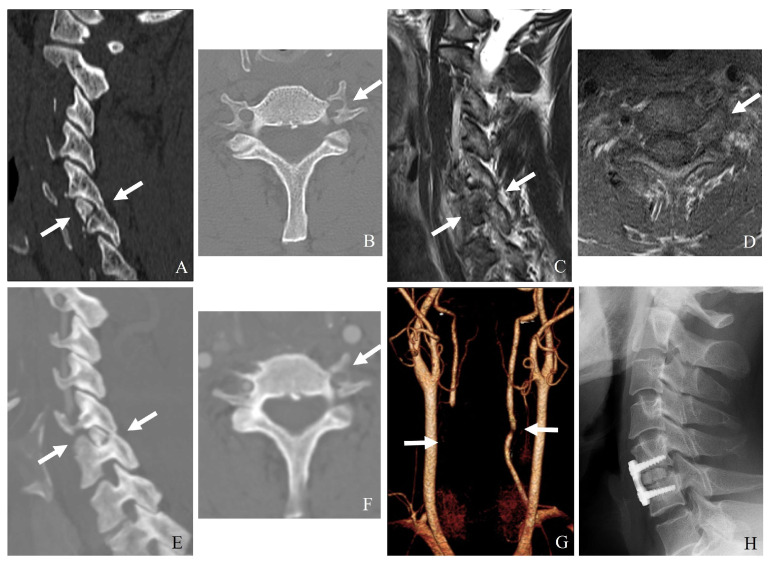 Figure 10