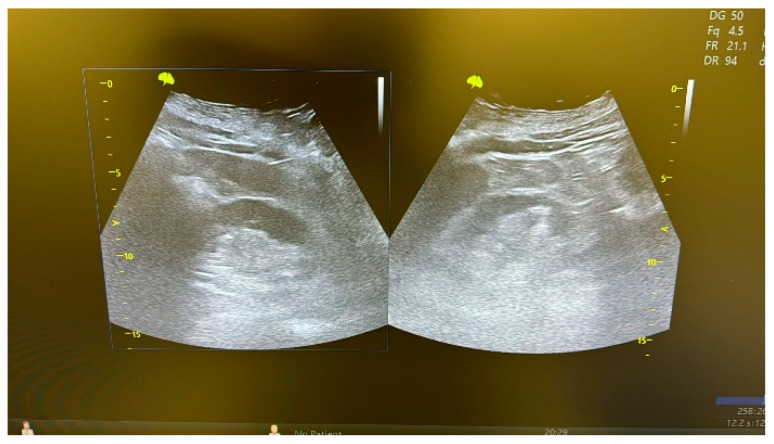 Figure 11