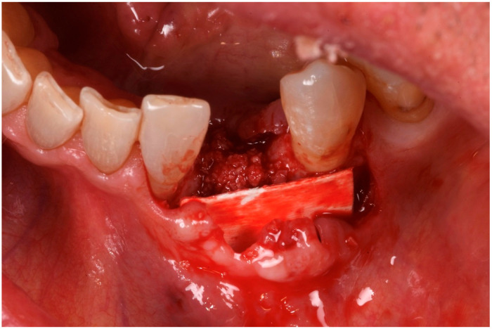 Figure 9