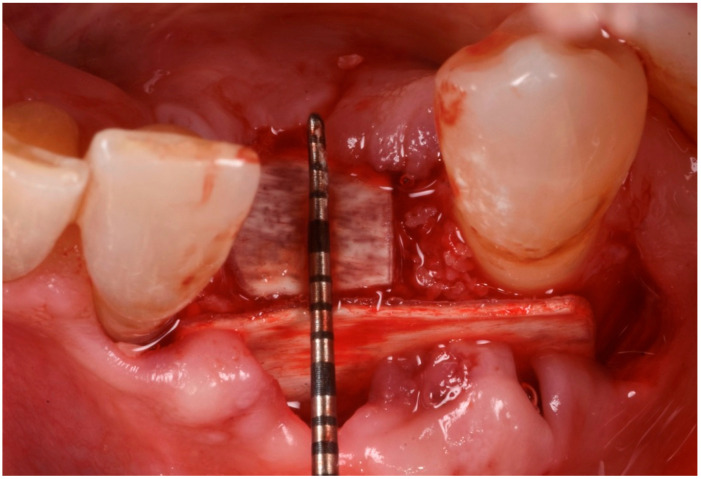 Figure 10