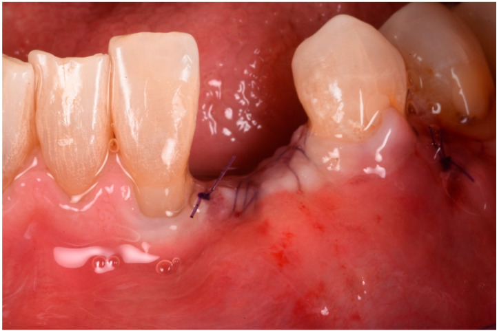 Figure 11