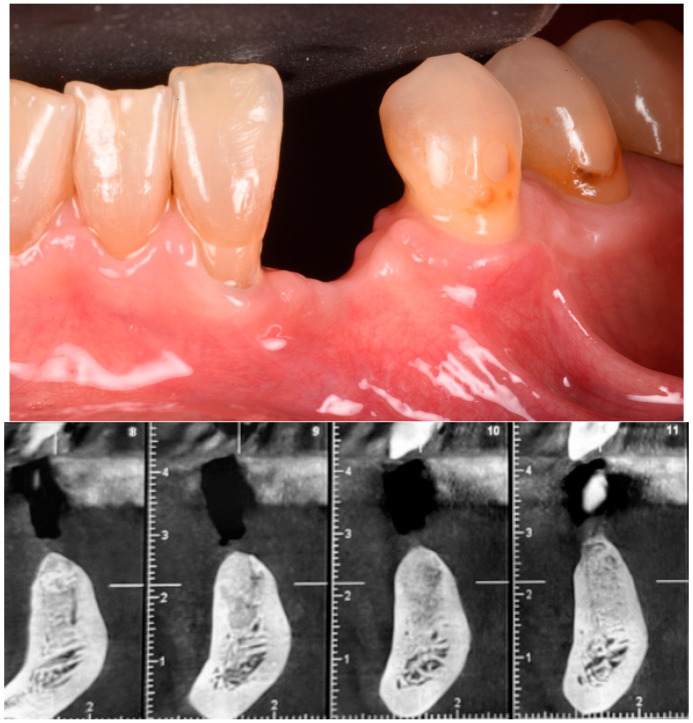 Figure 12