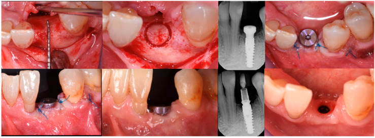 Figure 13