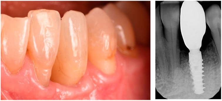 Figure 14