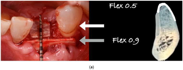 Figure 15