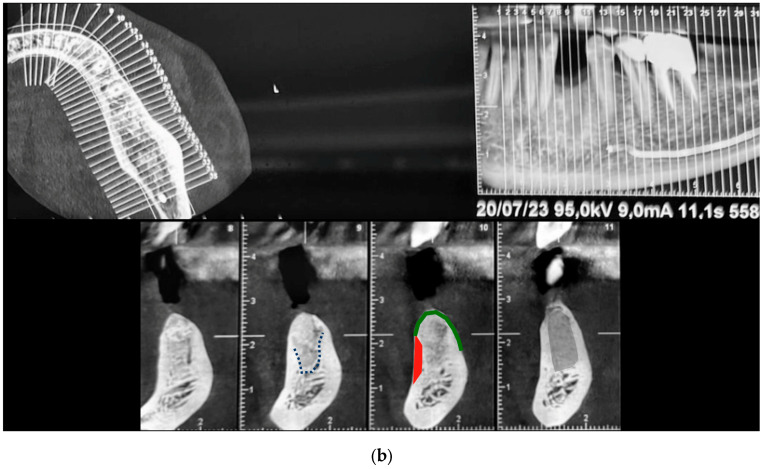 Figure 16