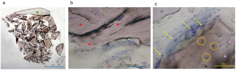 Figure 17