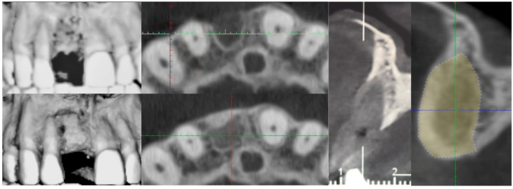 Figure 19