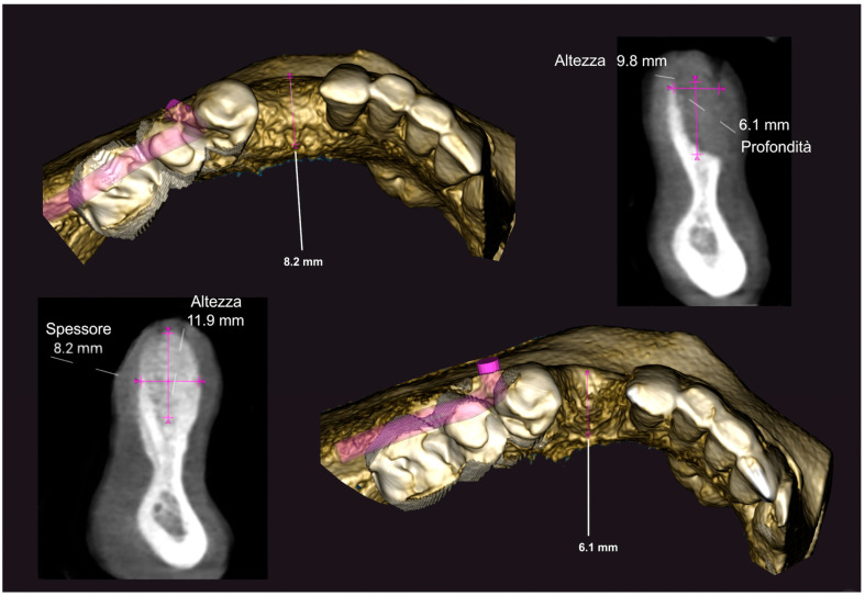 Figure 20