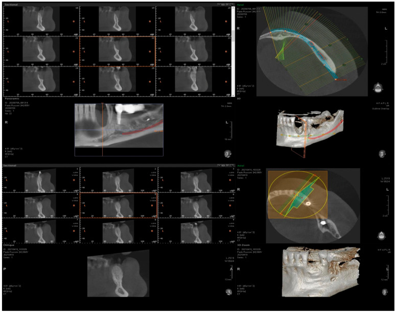 Figure 21