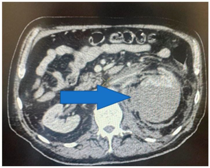 Figure 10