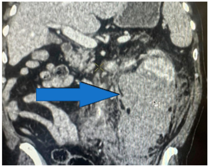 Figure 11