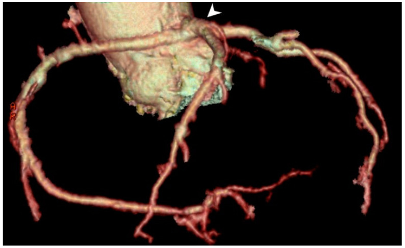 Figure 5