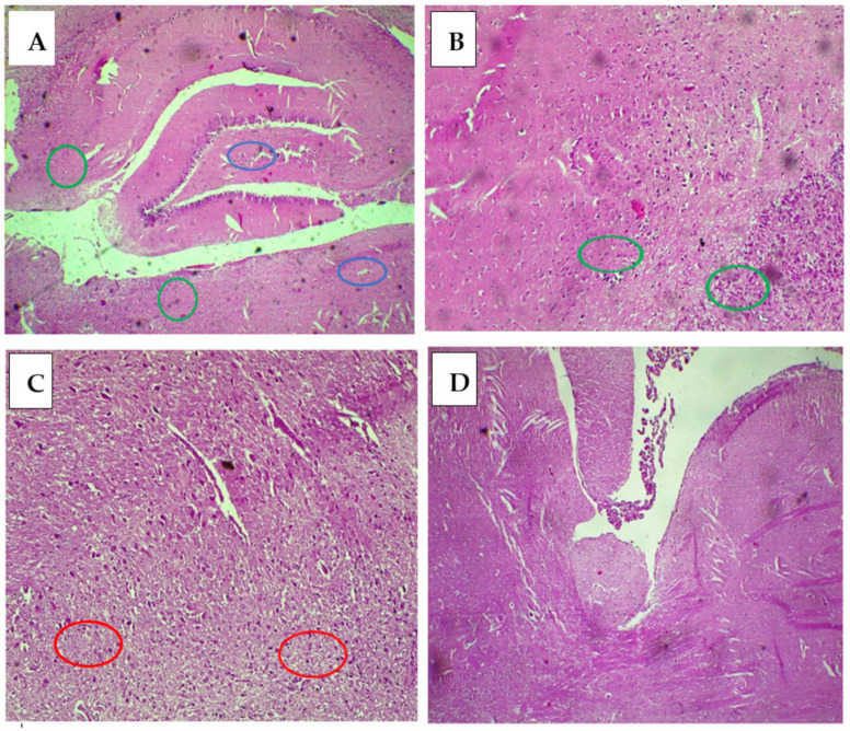Figure 11