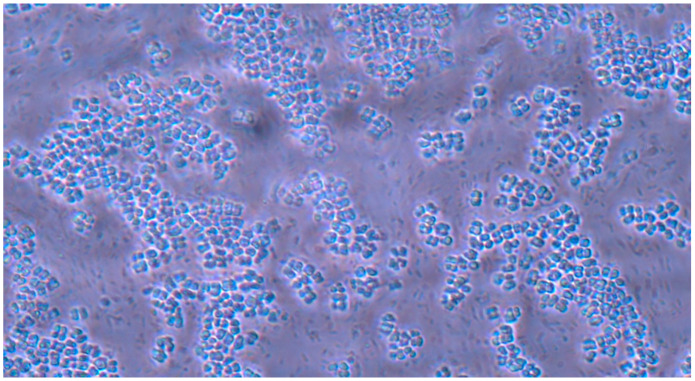 Figure 11