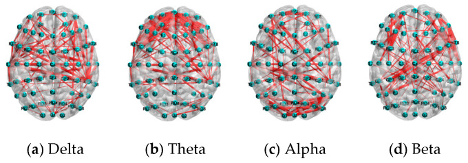 Figure 18
