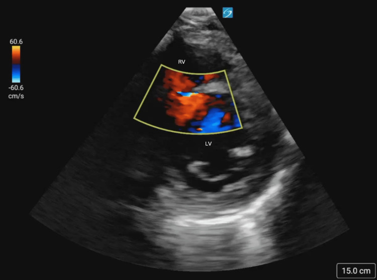 Figure 5