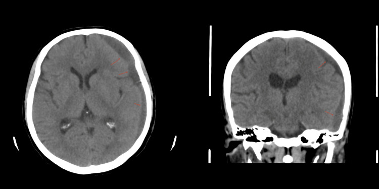Figure 7