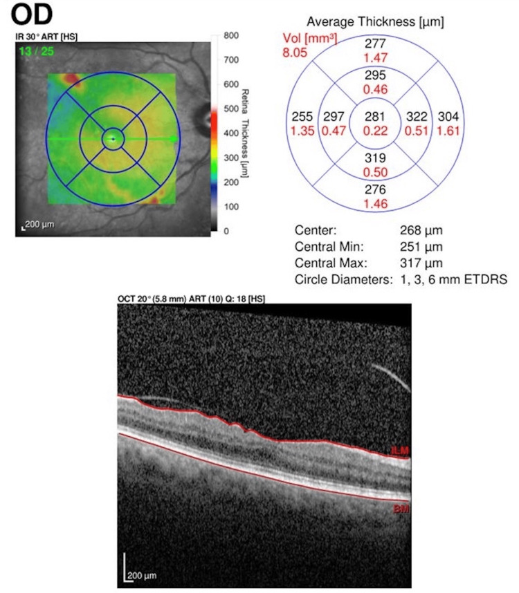Figure 6