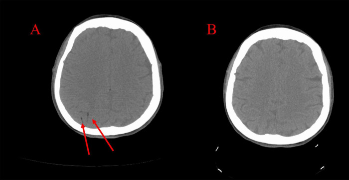 FIGURE 2