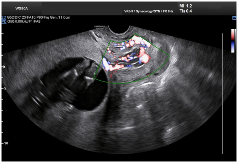 Figure 2